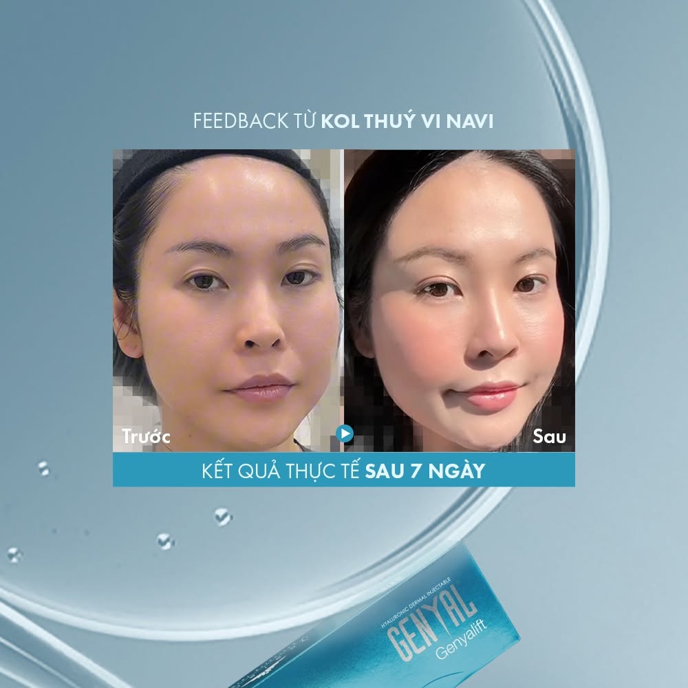 Xcelens Genyal Genyalift – Skin Booster Thu Nhỏ Lỗ Chân Lông, Trẻ Hóa Da