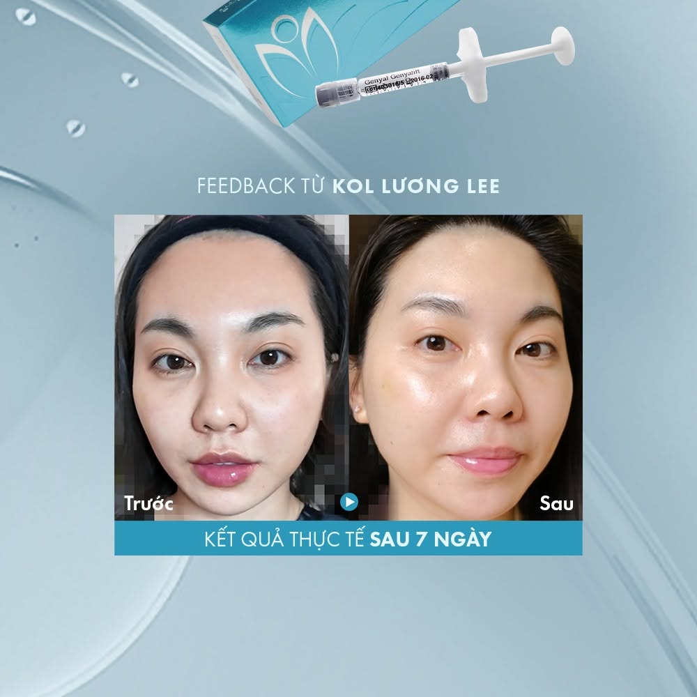 Xcelens Genyal Genyalift – Skin Booster Thu Nhỏ Lỗ Chân Lông, Trẻ Hóa Da