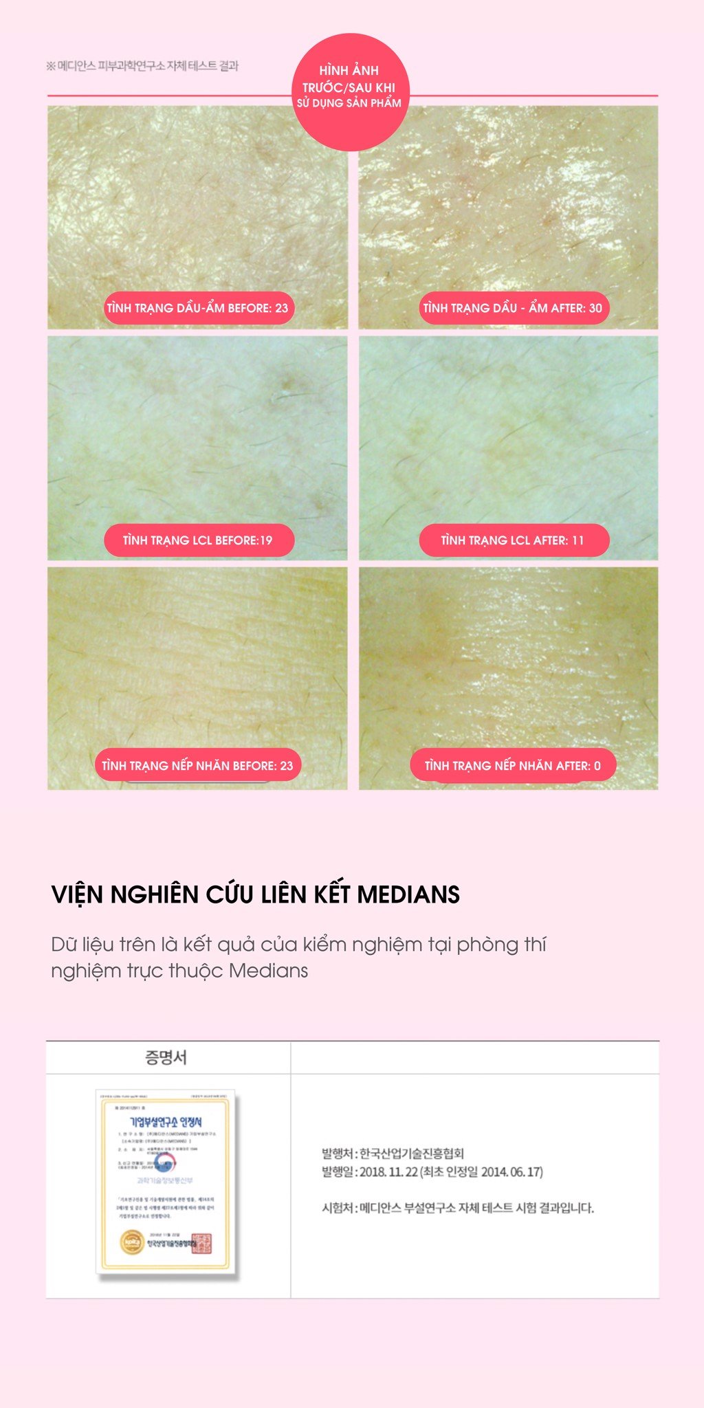 Ahohaw-peptide-hydrogel-multi-cream-kem-duong-botox-peptide-phuc-hoi-amp-cai-thien-nep-nhan_Ahohaw peptide hydrogel multi cream 3.jpg