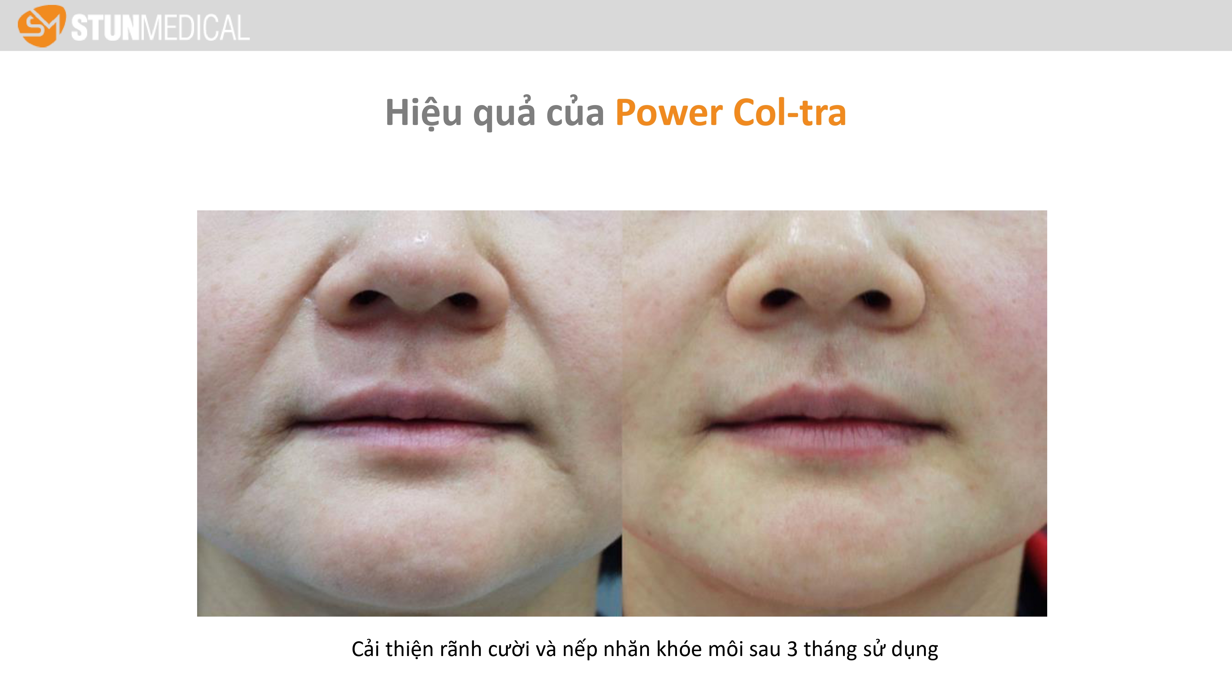 Power-Col-tra-ppt_page-0020.jpg