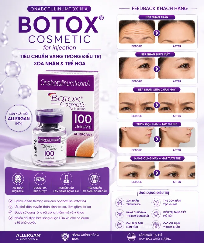 Botox Allergan Mỹ 100 Units – Giải pháp xóa nhăn & thon gọn 1.webp