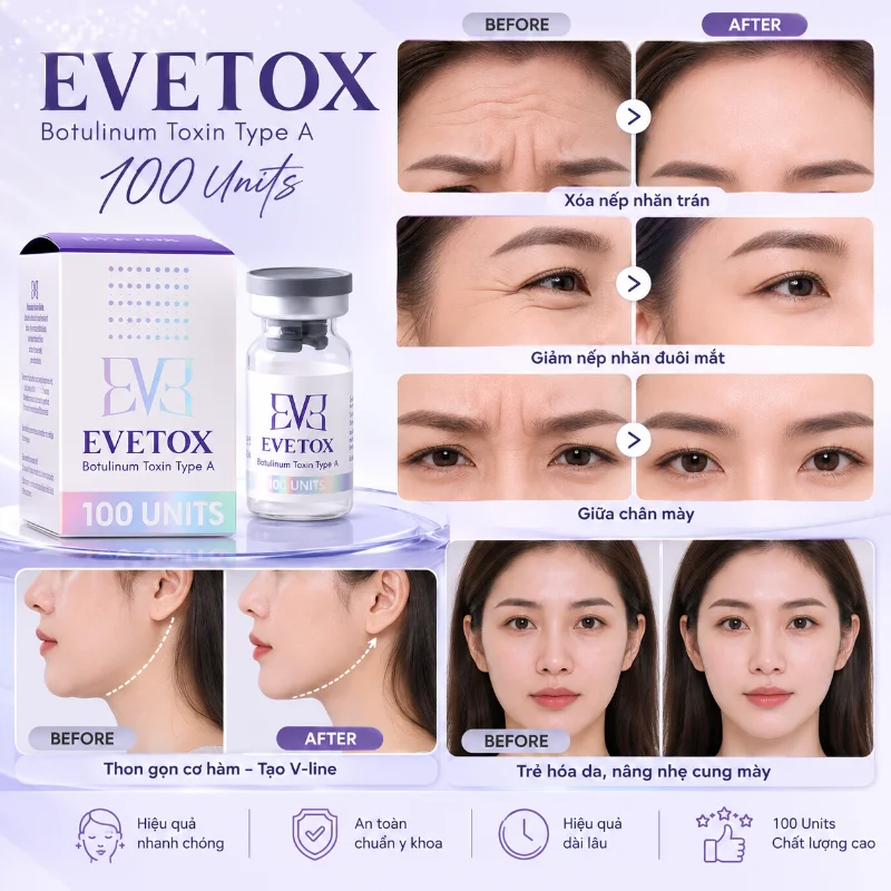 Botox EVETOX 100 – Giải Pháp Xóa Nhăn, Thon Gọn Gương Mặt Chuẩn Hàn Quốc 4.webp