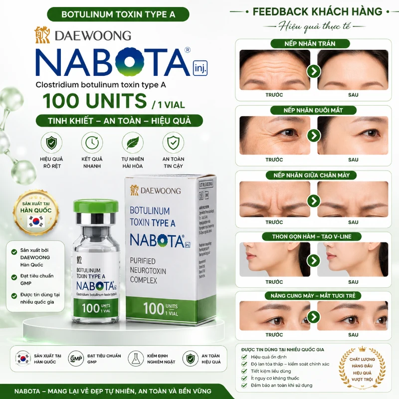 Botox Nabota Botulium Toxin Type A 100 Units xoá nhăn, thon gọn cơ 1.webp