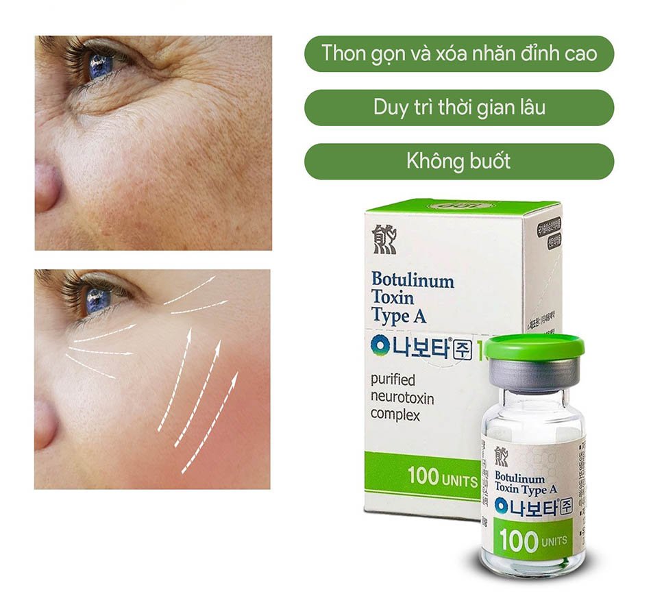 Botox-Nabota-Botulium-Toxin-Type-A-100-Units-xoa-nhan-thon-gon-co_Botox Nabota Botulium Toxin Type A 100 Units xoá nhăn, thon gọn cơ.jpg