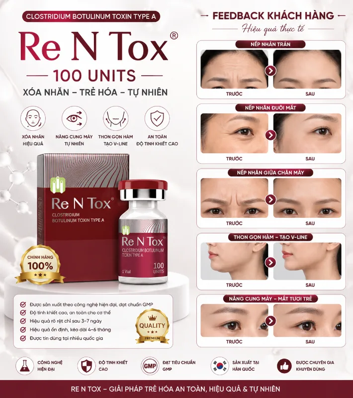 Botox Rentox Botulinum Toxin Type A 100 Units Hàn Quốc - Hỗ Trợ Xóa Nhăn, Thon Gọn Cơ 5.webp