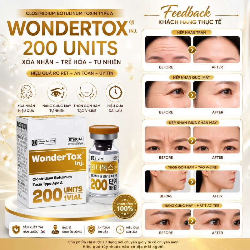 Botox Wondertox 200 Unit Hàn Quốc 8.webp