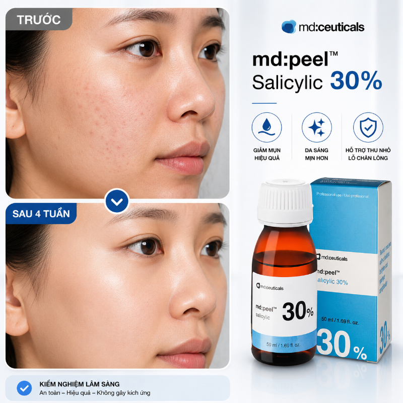 Dung dịch peel loại bỏ mụn sưng viêm cấp độ 3,4 3.jpg