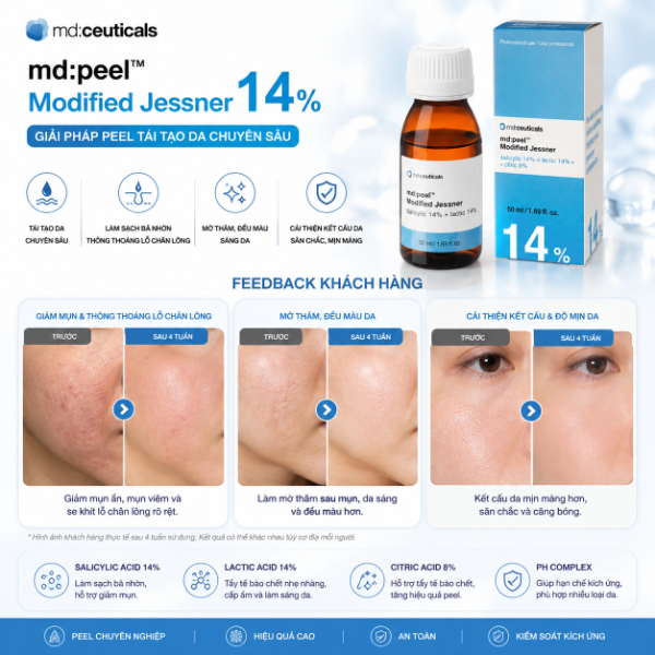 Dung dịch peel nám mảng lỗ chân lông to.jpg