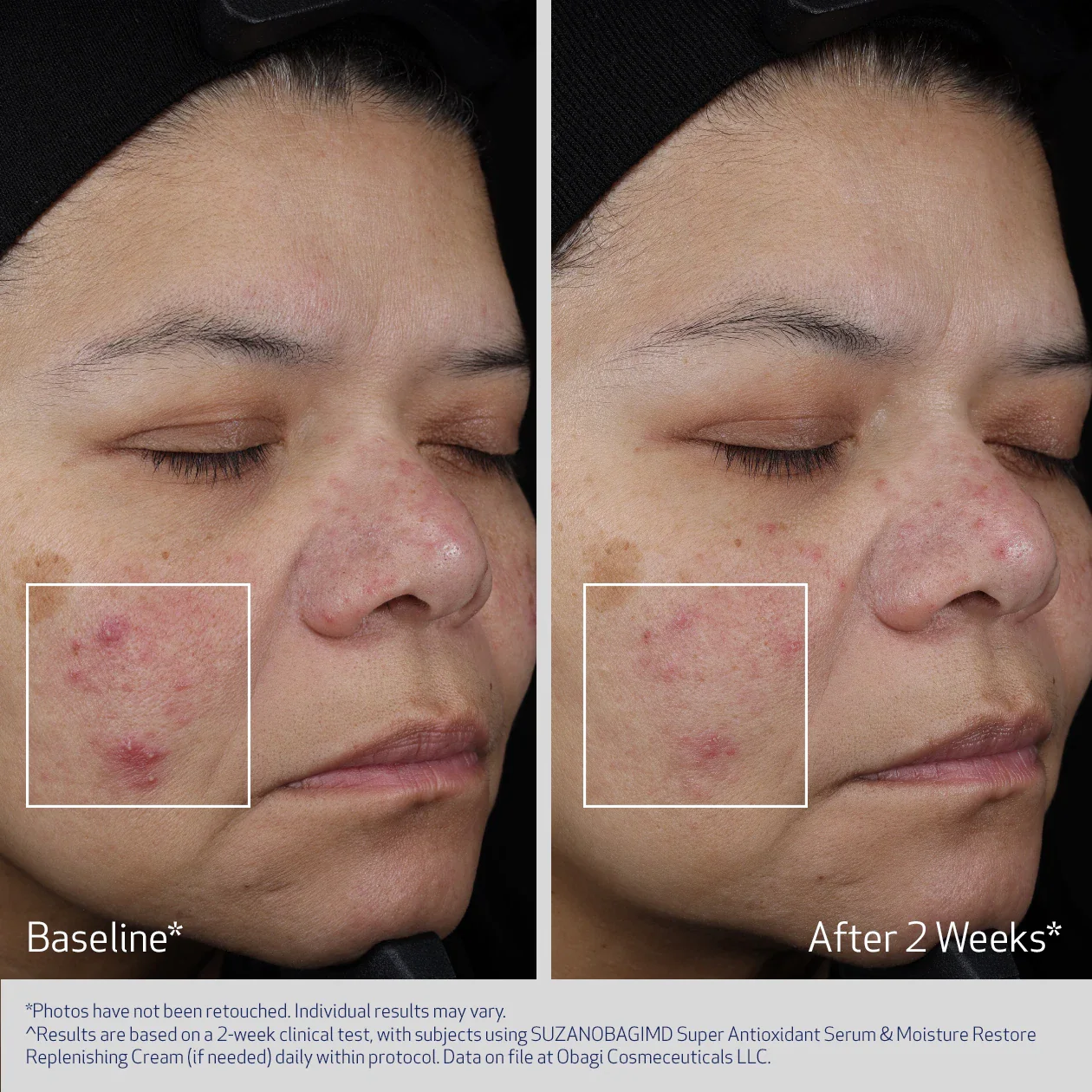 SUZANOBAGIMD® Super Antioxidant Serum 1.webp