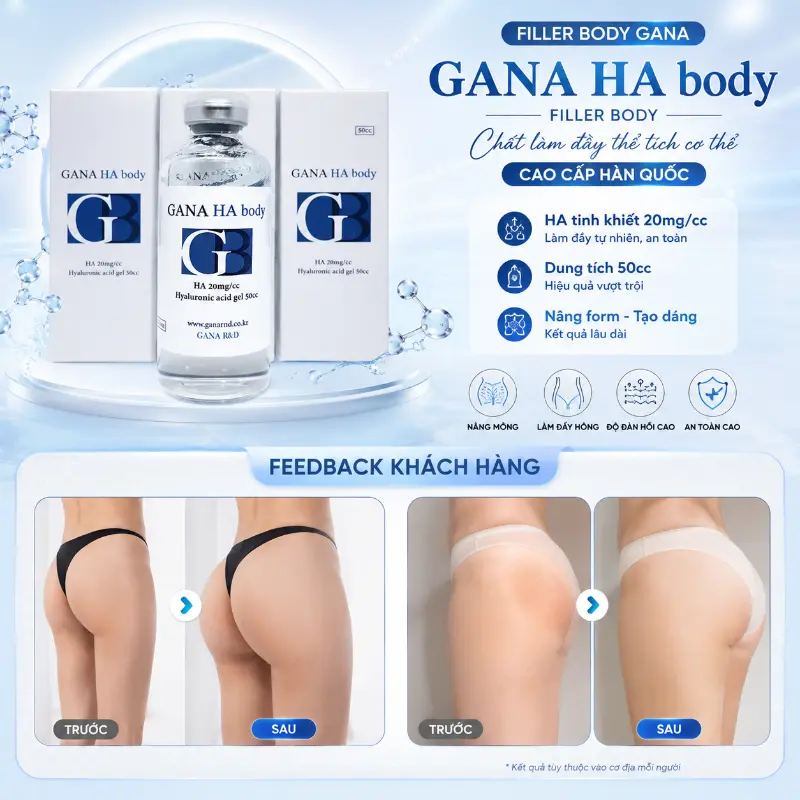 Filler Body Gana – Chất Làm Đầy Thể Tích Cơ Thể Cao Cấp Hàn Quốc.webp