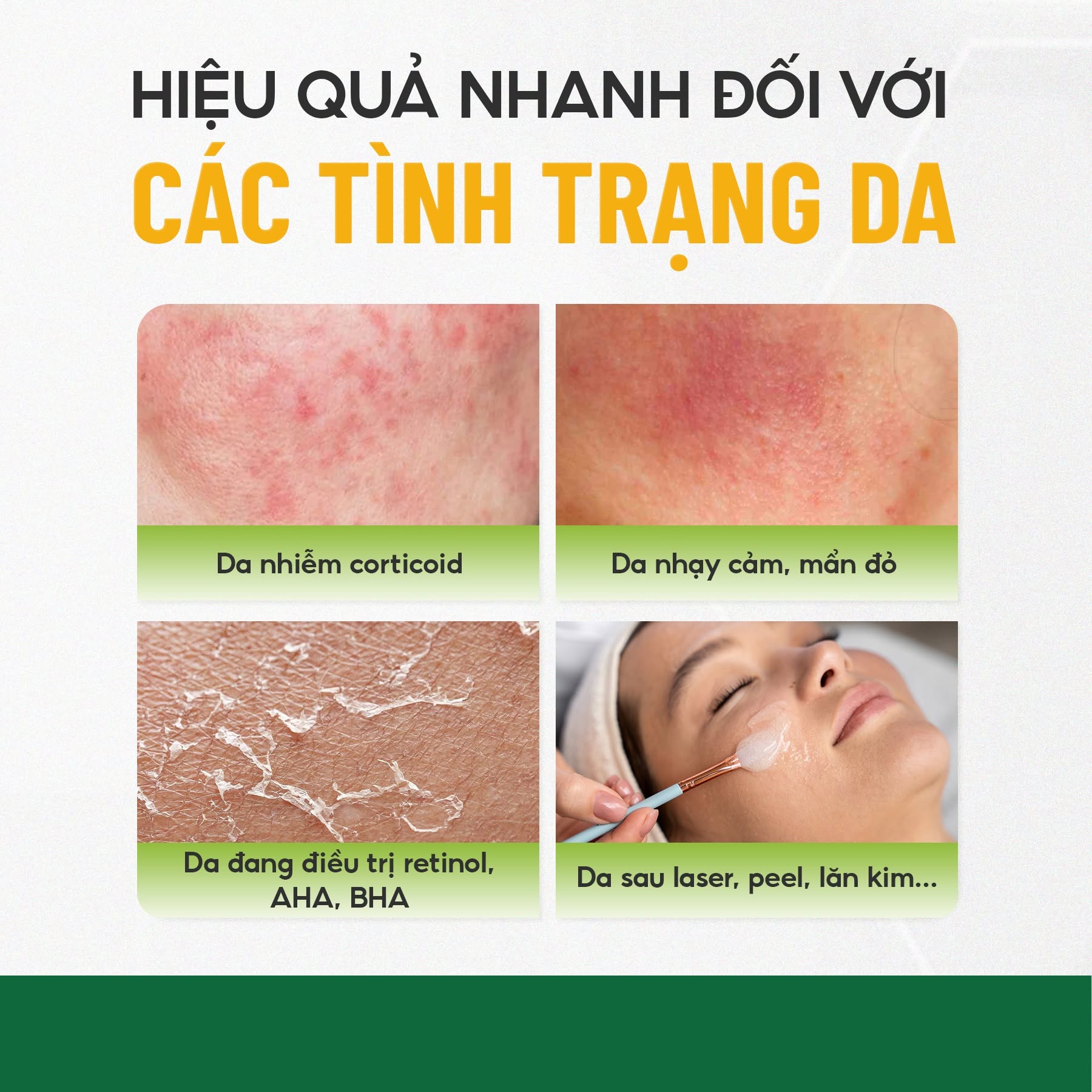Huyết Thanh Phục Hồi Làm Dịu, Căng Bóng Da Innoaesthetics Skin Repair 60g 1.jpg