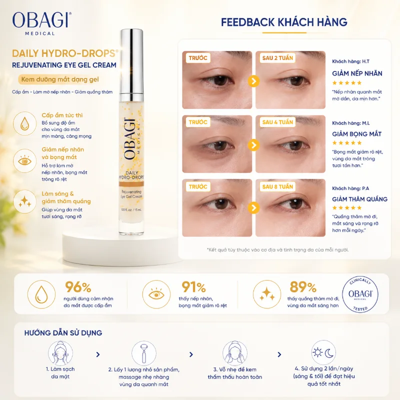 Kem Dưỡng Mờ Nếp Nhăn Vùng Mắt Obagi Daily Hydro-Drops® Rejuvenating Eye Gel Cream 15ml 1.webp