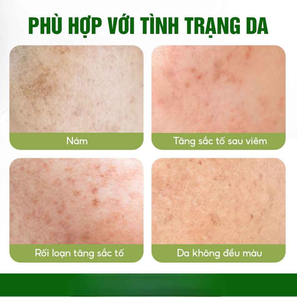 Kem chăm sóc da không đều màu Innoaesthetics Inno-Derma Dark Spot Eraser 24H (4).jpg