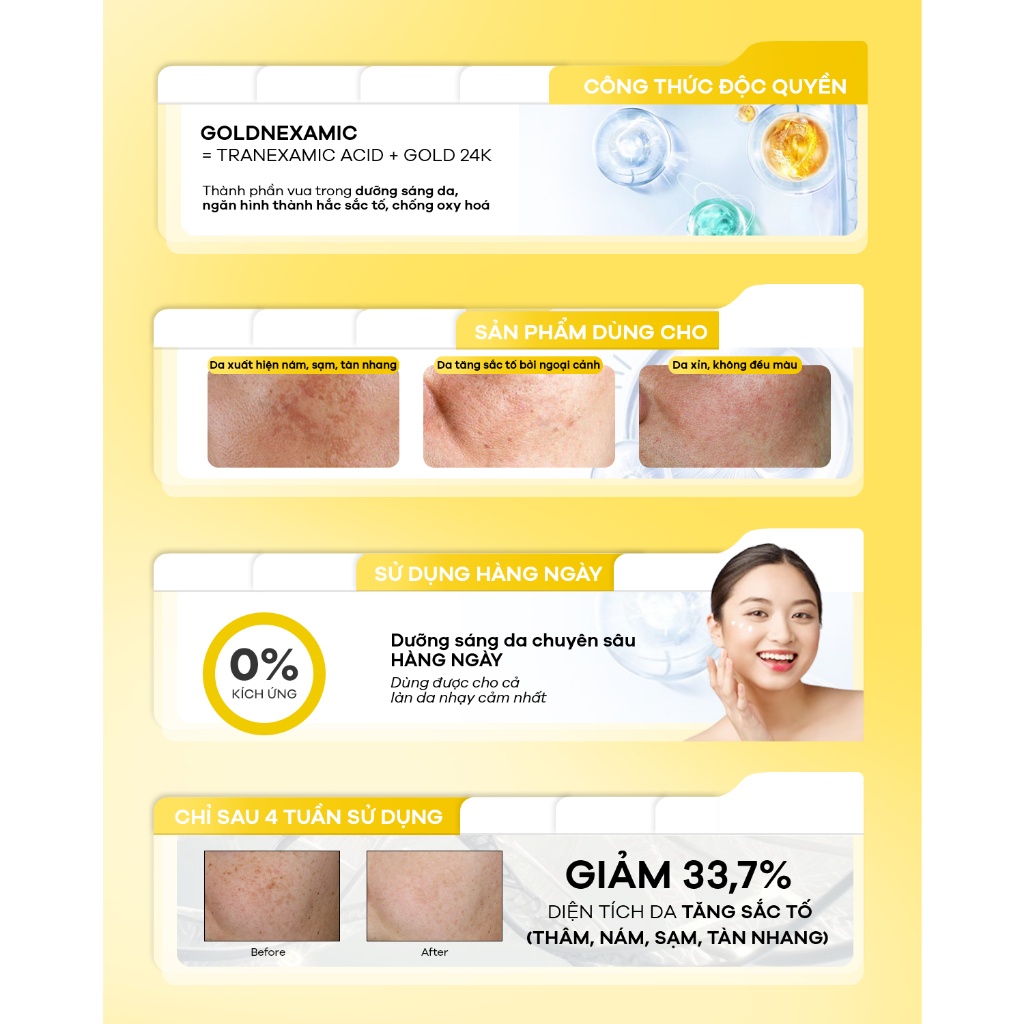 Kem-duong-trang-cai-thien-sac-to-da-da-tang-Anodin-GOLDNEXAMIC-10X-Cream-35ml_Anodin GOLDNEXAMIC™ 10X Cream 35ml.jpg