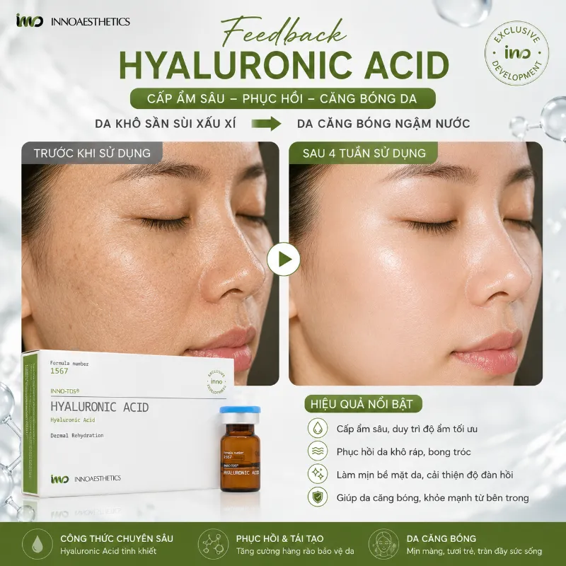 Meso Innoaesthetics Hyaluronic Acid – Hoạt Chất Cấp Ẩm, Làm Đầy Và Căng Bóng Da 2.5ml 6.webp