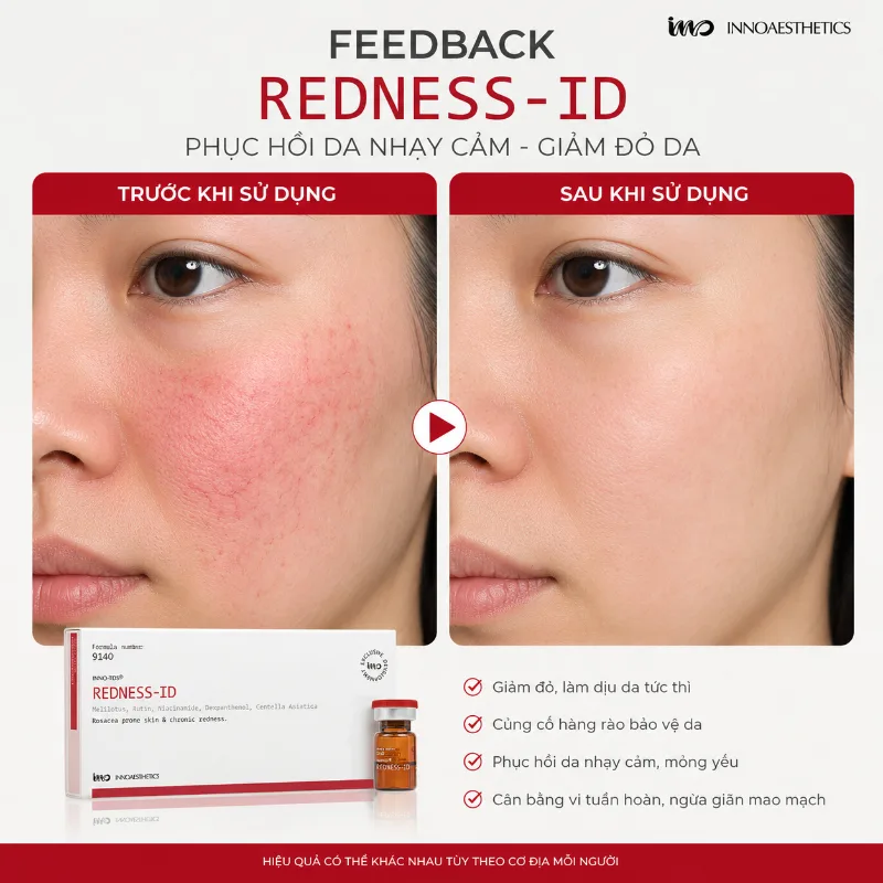 Meso Innoaesthetics REDNESS-ID 6.webp