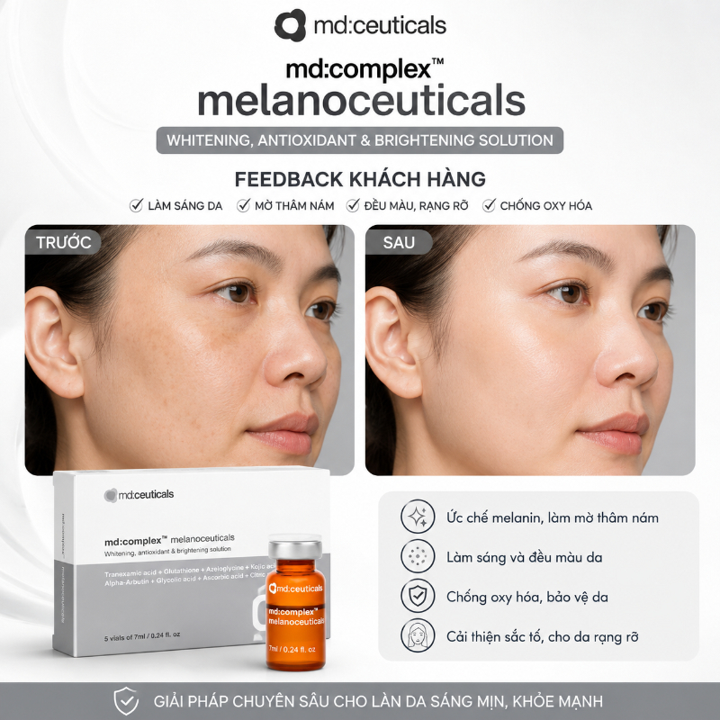 Meso ức chế nám, tàn nhang trắng sáng da 2.jpg