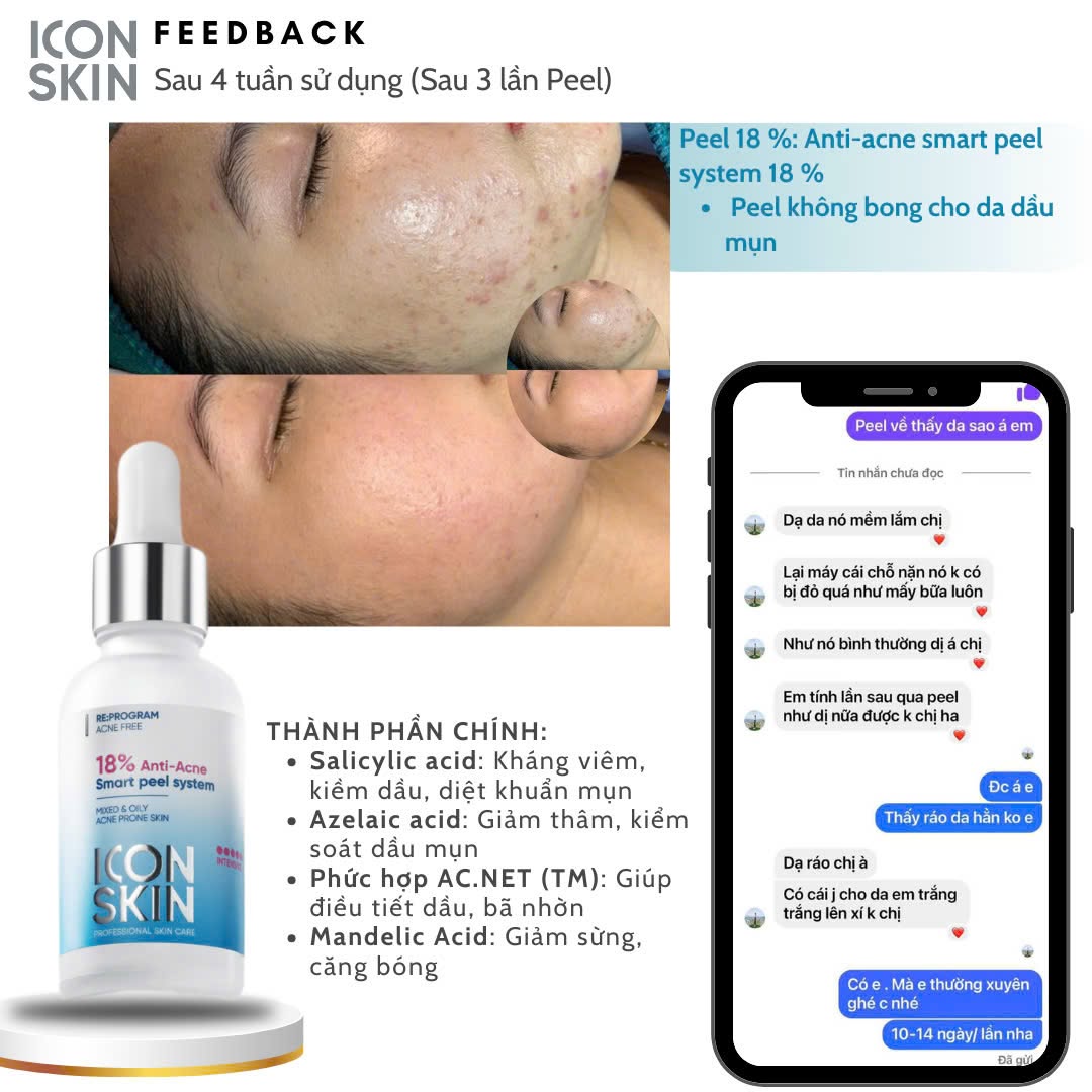 Peel da không bong cho da dầu, da hỗn hợp Icon Skin 18% Anti-Acne Peel System 9.jpg
