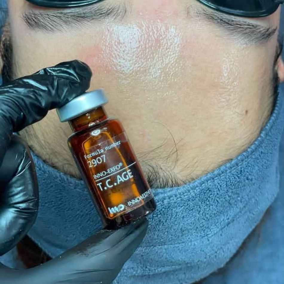 Peel tái tạo da, cho da sẹo rỗ Innoaesthetics T.C. Age (4).jpg