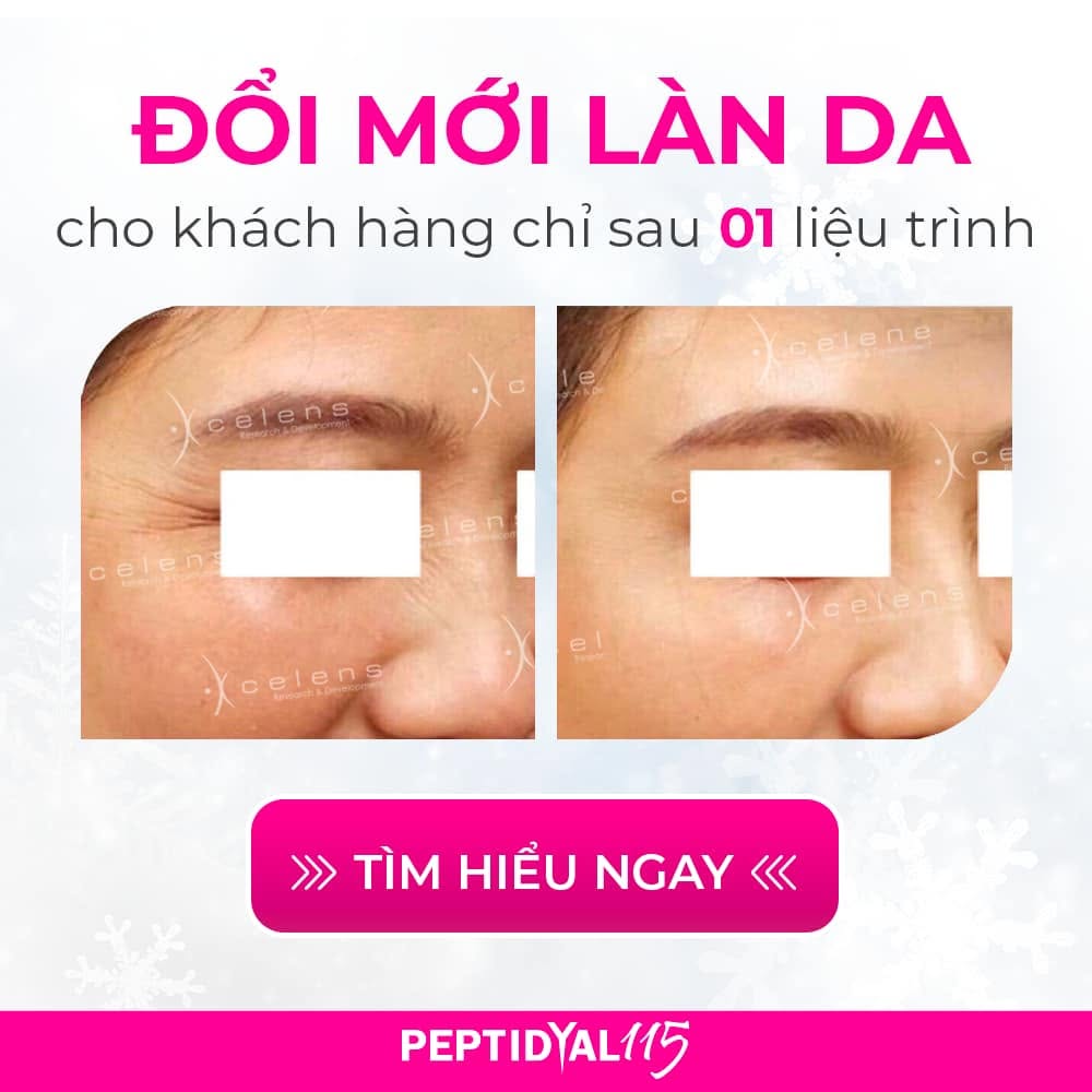 Xcelens Peptidyal 115 – Huyết Thanh Meso Trẻ Hóa, Căng Bóng Và Săn Chắc Da 4.jpg