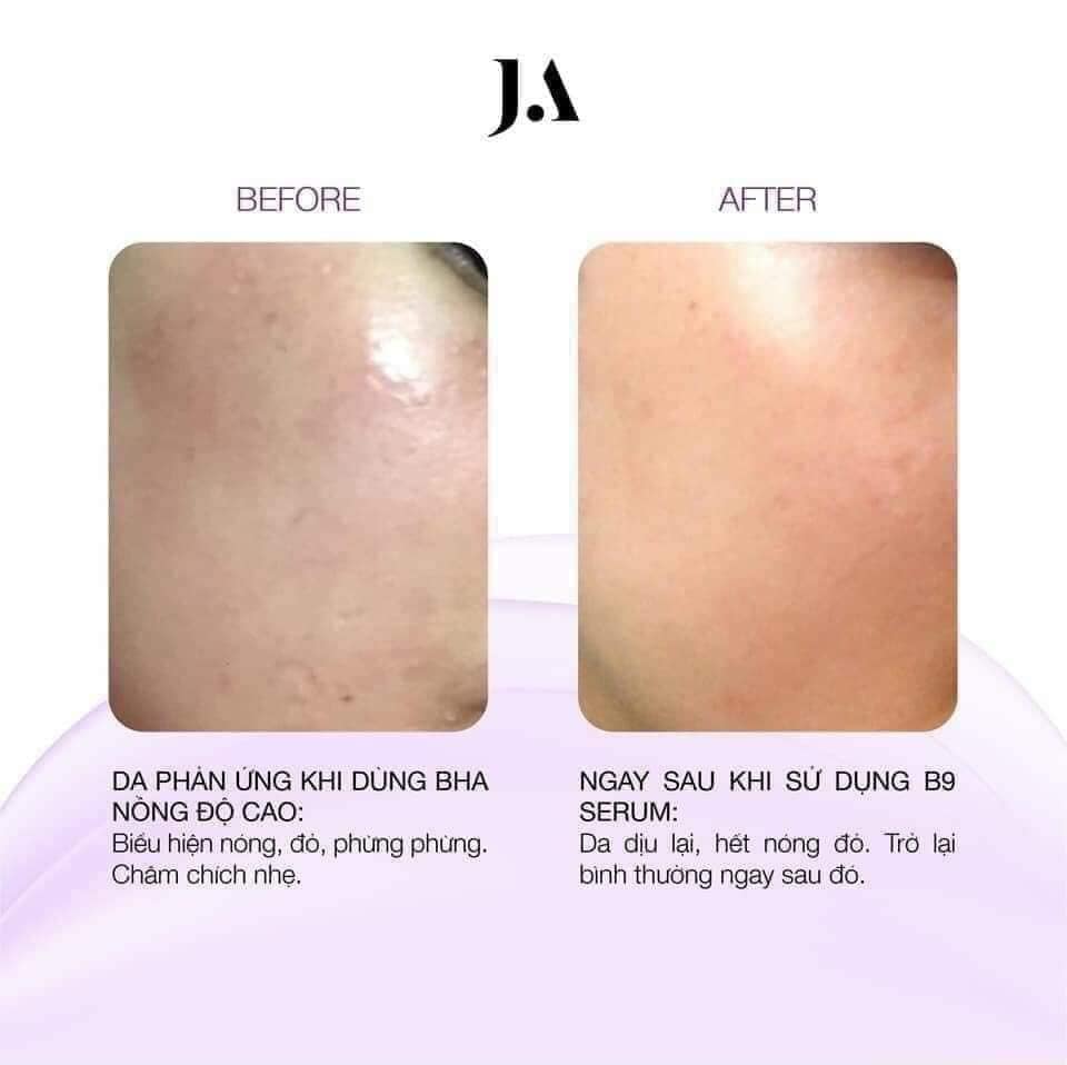 Serum-B9-Juliette-Armand-Folic-Acid-20ml-giam-kich-ung-phuc-hoi-da_Serum B9 Juliette Armand Folic Acid 20ml giảm kích ứng phục hồi da-1.jpg