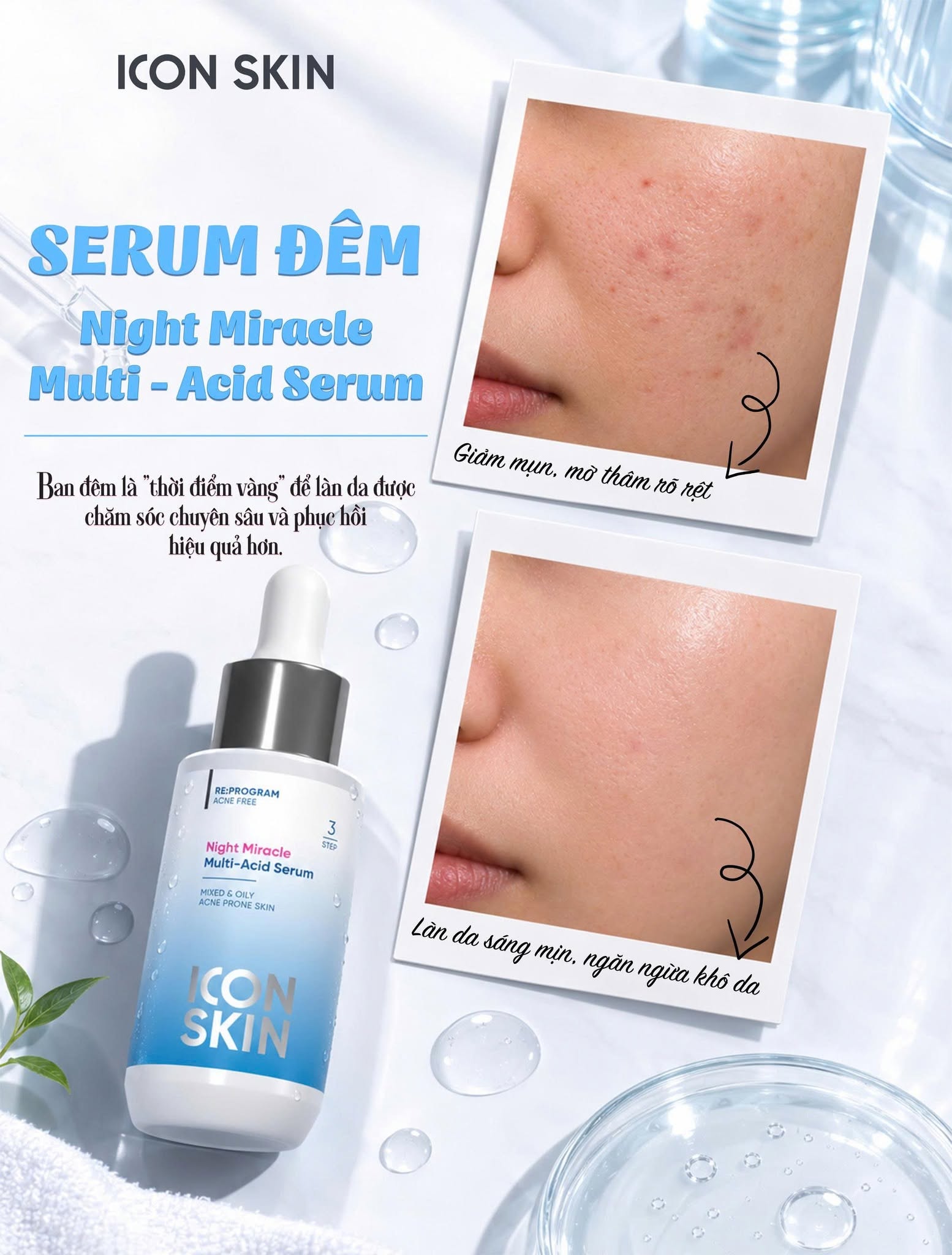 Serum ban đêm cho da dầu, da hỗn hợp Icon Skin Night Miracle Multi-Acid Serum.jpg