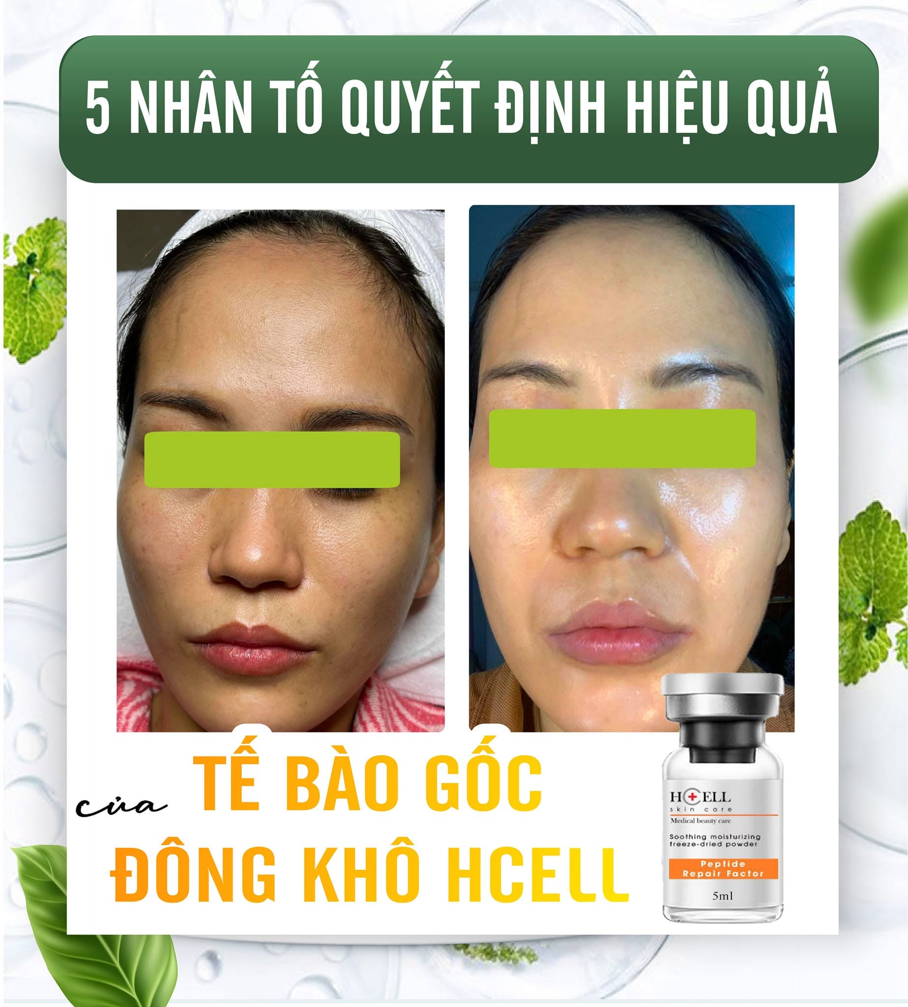 Tế Bào Gốc Hcell Đông Khô Peptide Repair Factor nuôi dưỡng, tái tạo phục hồi da 2.jpg