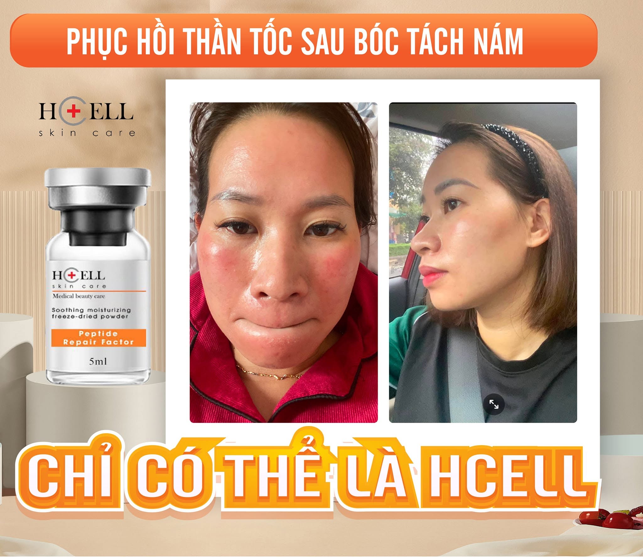 Tế Bào Gốc Hcell Đông Khô Peptide Repair Factor nuôi dưỡng, tái tạo phục hồi da 4.jpg