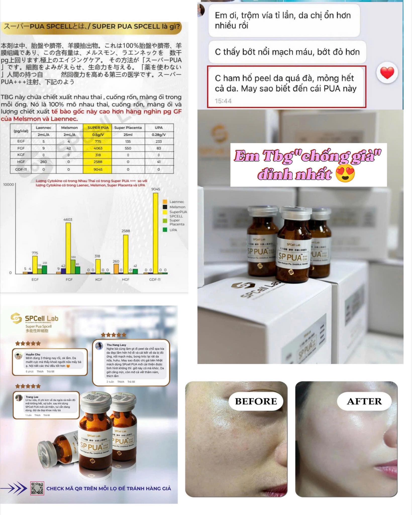 Te-bao-goc-tre-hoa-lan-da-sang-min-cai-thien-voc-dang-khoe-dep-SPCell-Lab-PUA-0-5G_Tế bào gốc trẻ hóa làn da sáng mịn, cải thiện vóc dáng khỏe đẹp SPCell Lab PUA 0.5G.jpg