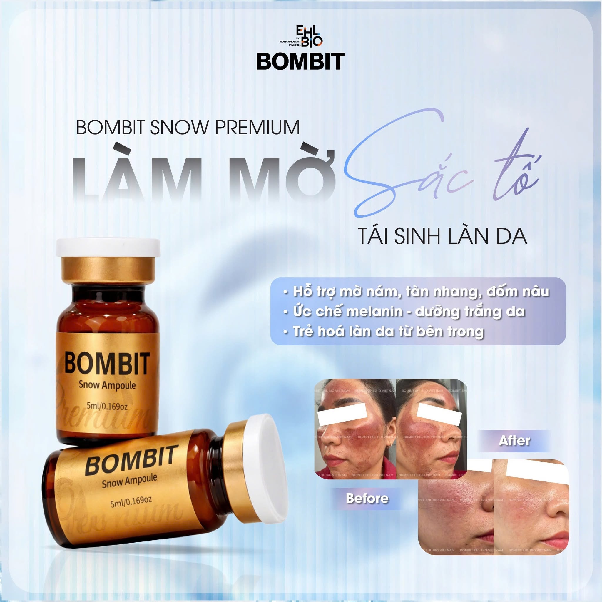 BOMBIT Snow Meso Hỗ Trợ Điều Trị Nám, Sạm Và Làm Sáng Da 5.jpg