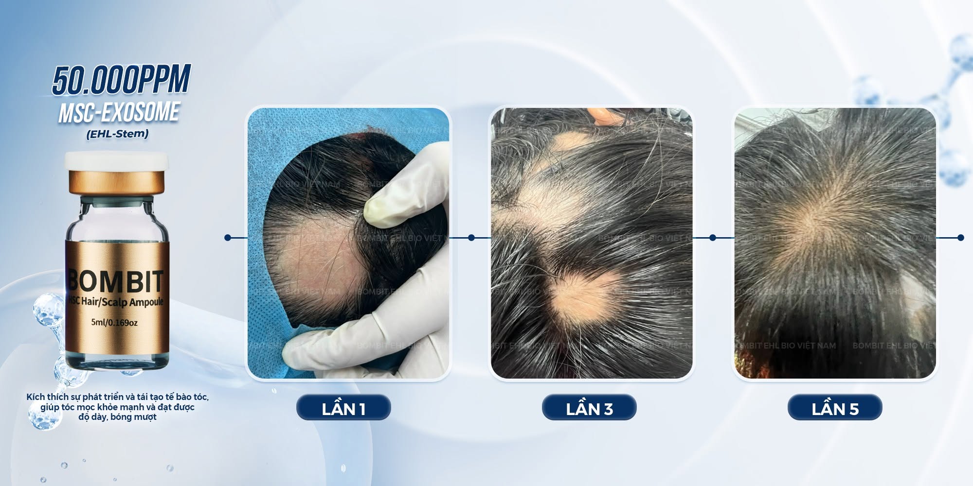Tinh Chất Hỗ Trợ Mọc Tóc, Giảm Rụng Tóc BOMBIT Hair Meso MSC Exosome 8.jpg