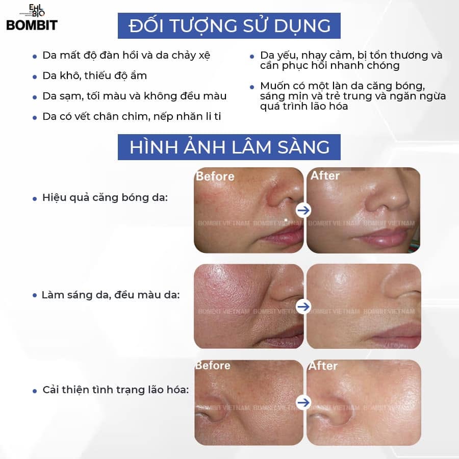 BOMBIT TOTAL SOLUTION AMPOULE 7.jpg