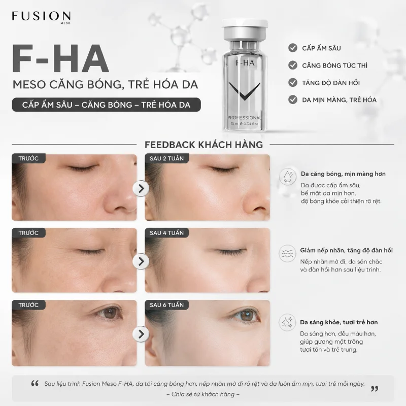 Meso Căng Bóng, Cấp Ẩm Và Trẻ Hóa Da Fusion F-HA 10ml 7.webp
