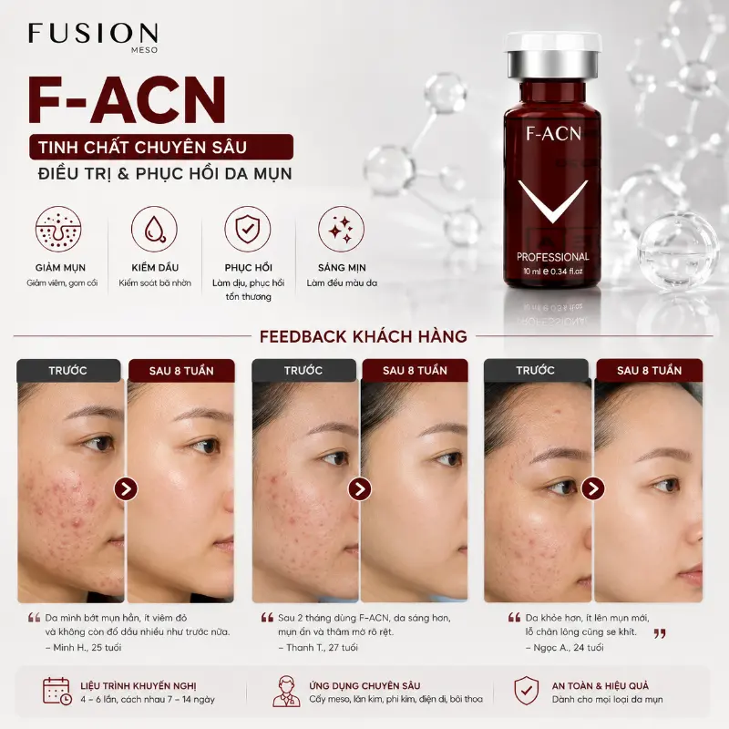 Tinh Chất Meso Trị Mụn Fusion Mesotherapy F-ACN 10ml – Hỗ Trợ Giảm Mụn, Thâm Và Kiểm Soát Dầu Nhờn 3.webp