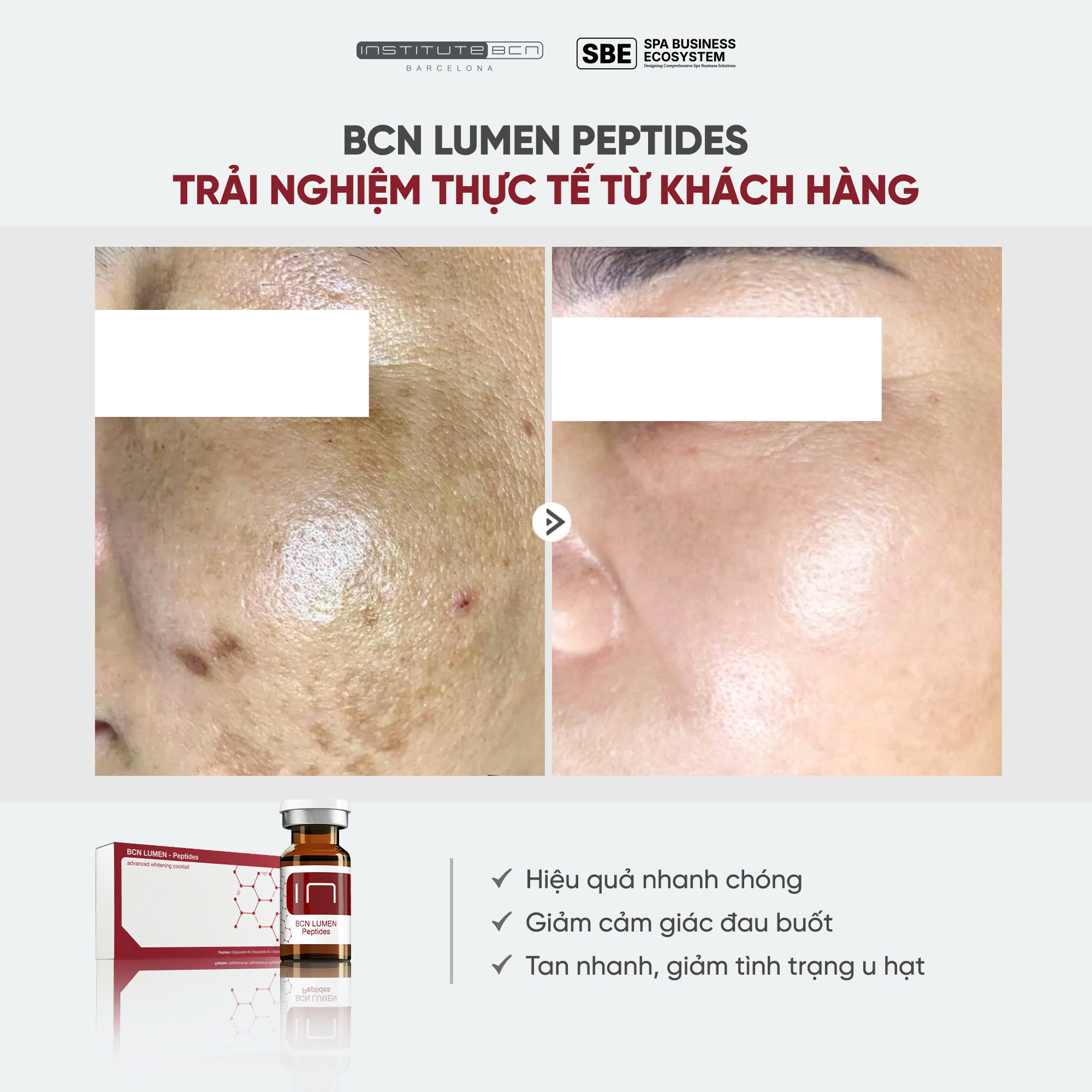 Tinh-chat-Lumen-Peptite-Insititute-BCN-uc-che-nam-sang-da_Tinh chất Lumen Peptide Institute BCN ức chế nám, sáng da 3.jpg