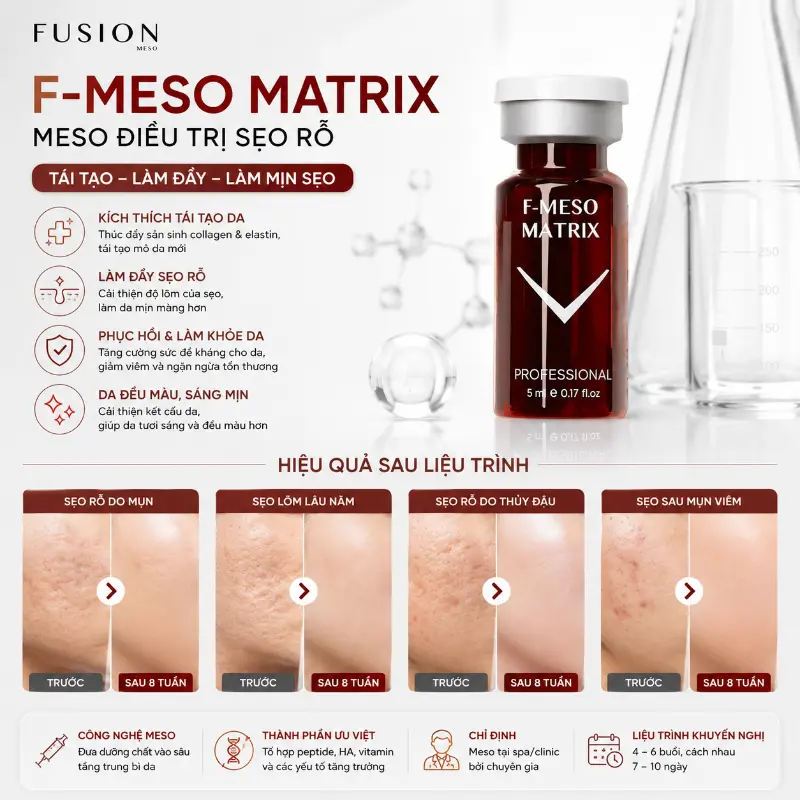 Tinh chất điều trị đầy sẹo lõm, sẹo rỗ Fusion F-Meso Matrix 5ml 5.webp