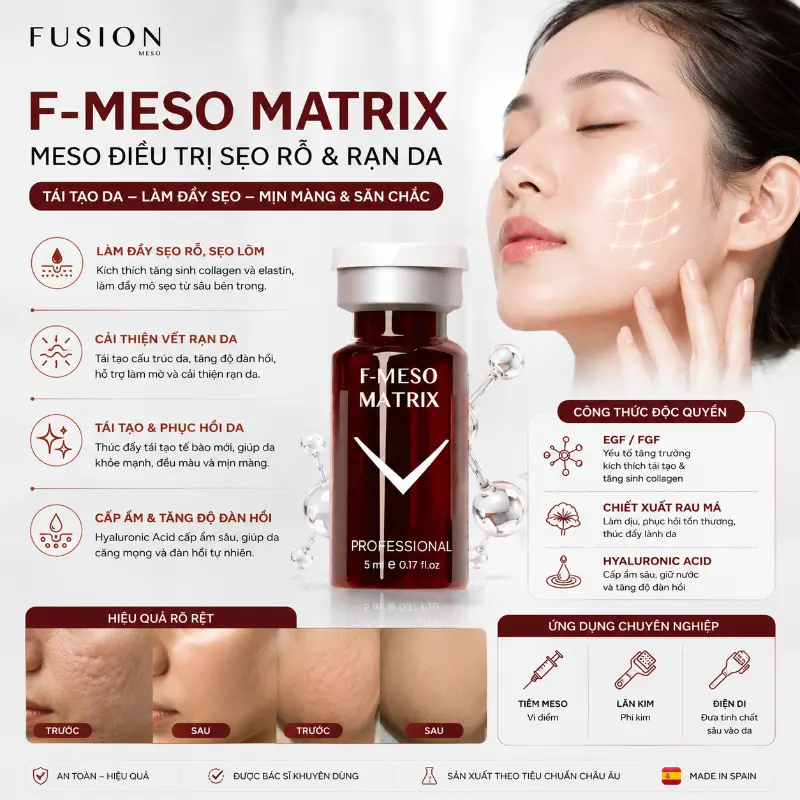 Tinh chất điều trị đầy sẹo lõm, sẹo rỗ Fusion F-Meso Matrix 5ml 1.webp