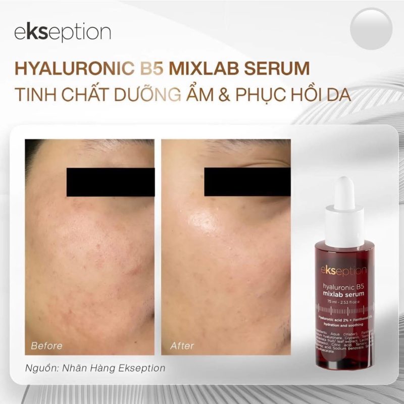 Tinh-chat-duong-am-va-lam-diu-da-EKSEPTION-HYALURONIC-B5-MIXLAB-SERUM_Tinh chất dưỡng ẩm và làm dịu da EKSEPTION HYALURONIC B5 MIXLAB SERUM 4.jpg
