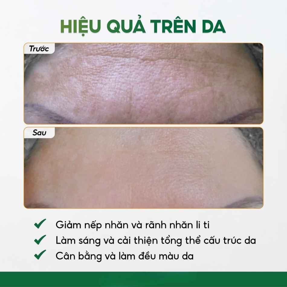 Tinh chất meso chống oxy hóa, dưỡng sáng da Innoaesthetics Restructurer (4).jpg