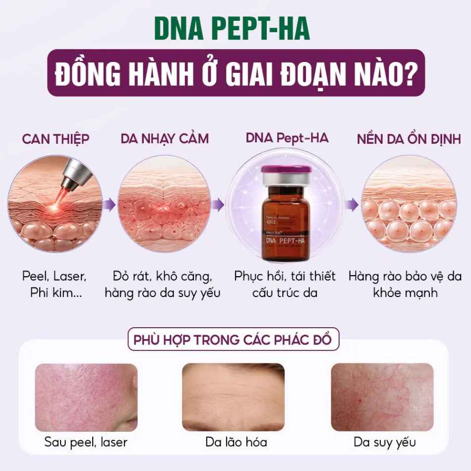 Tinh chất meso phục hồi, tái tạo và trẻ hóa da Innoaesthetics DNA PEPT-HA.jpg