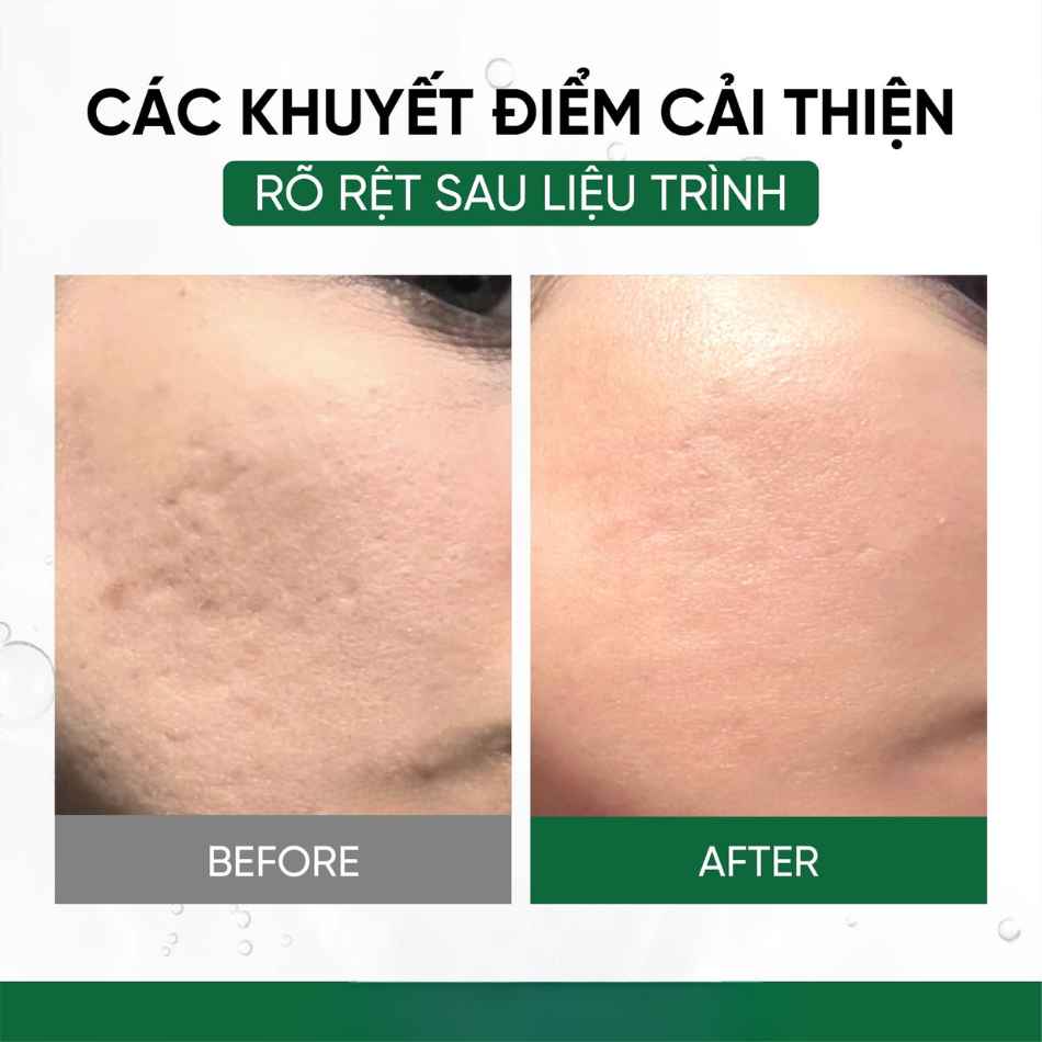 Tinh chất meso phục hồi, trẻ hóa và cải thiện đàn hồi da Innoaesthetics TIGF (4).jpg