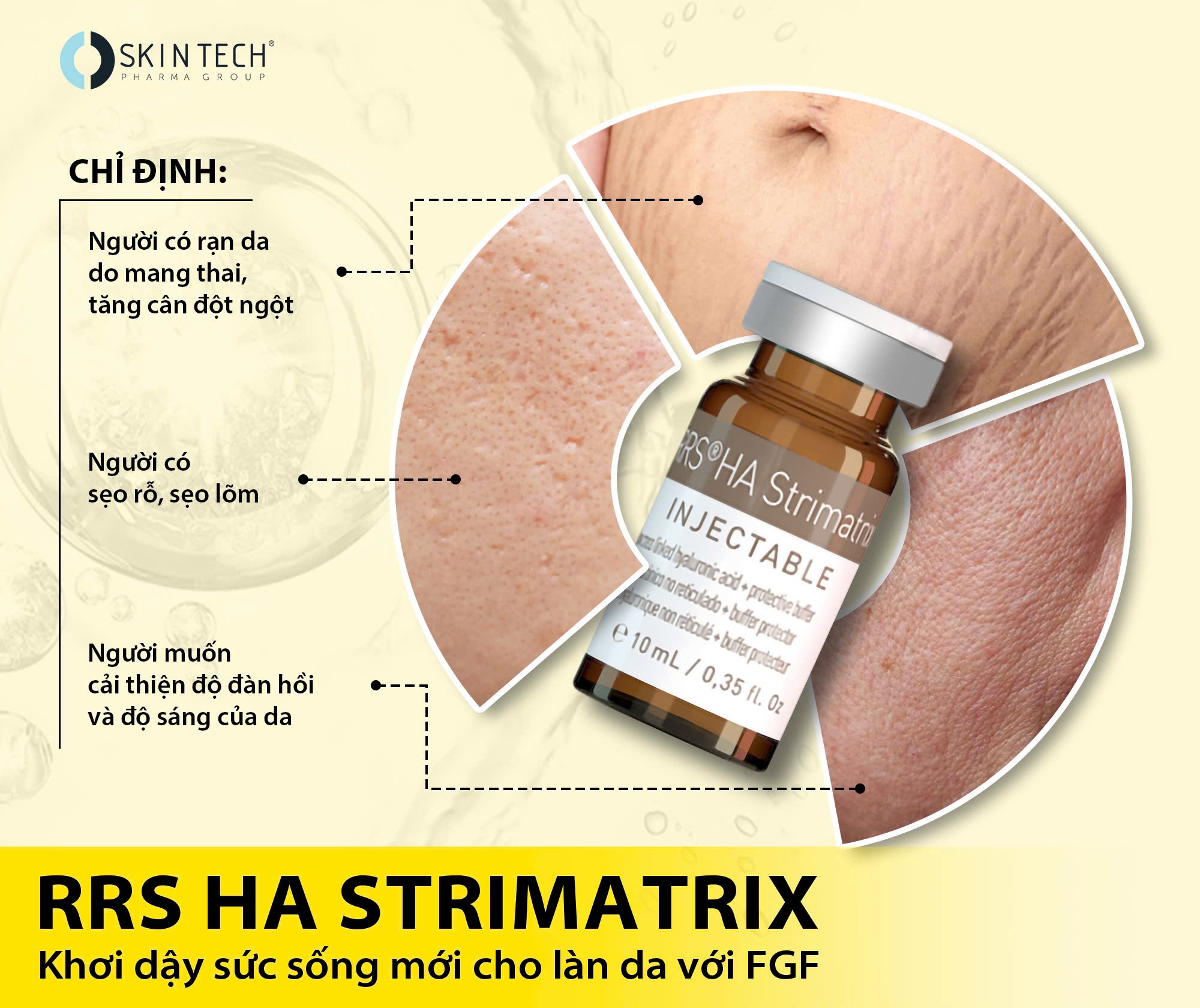 MESO TRỊ RẠN DA, SẸO RRS HA STRIMATRIX SKIN TECH 10ML 1.jpg