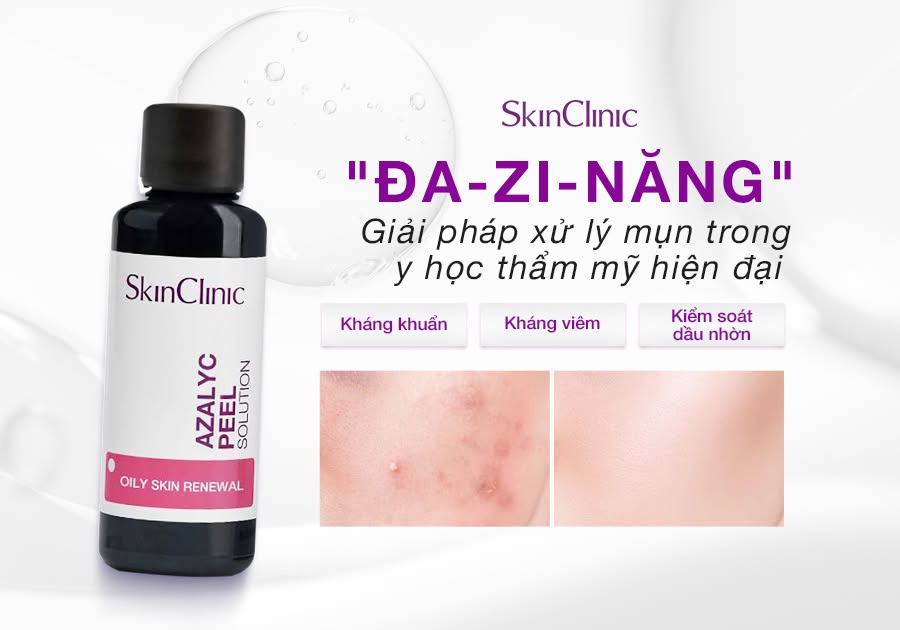 Tinh chất peel không bong điều tiết bã nhờn ức chế hình thành mụn SkinClinic Azalyc Peel Solution.jpg