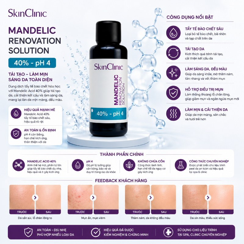 Tinh chất peel không bong giảm tiết bã nhờn mụn trứng cá SkinClinic Mandelic Renovation Solution 1.jpg