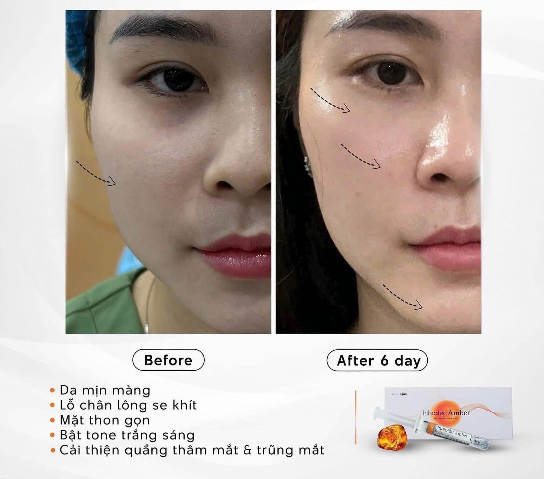 Tinh-chat-tiem-BAP-tre-hoa-da-da-tang-Inbiotec-Amber-hop-2ml_Tinh chất tiêm BAP trẻ hóa da đa tầng Inbiotec Amber hộp 2ml (3).jpg