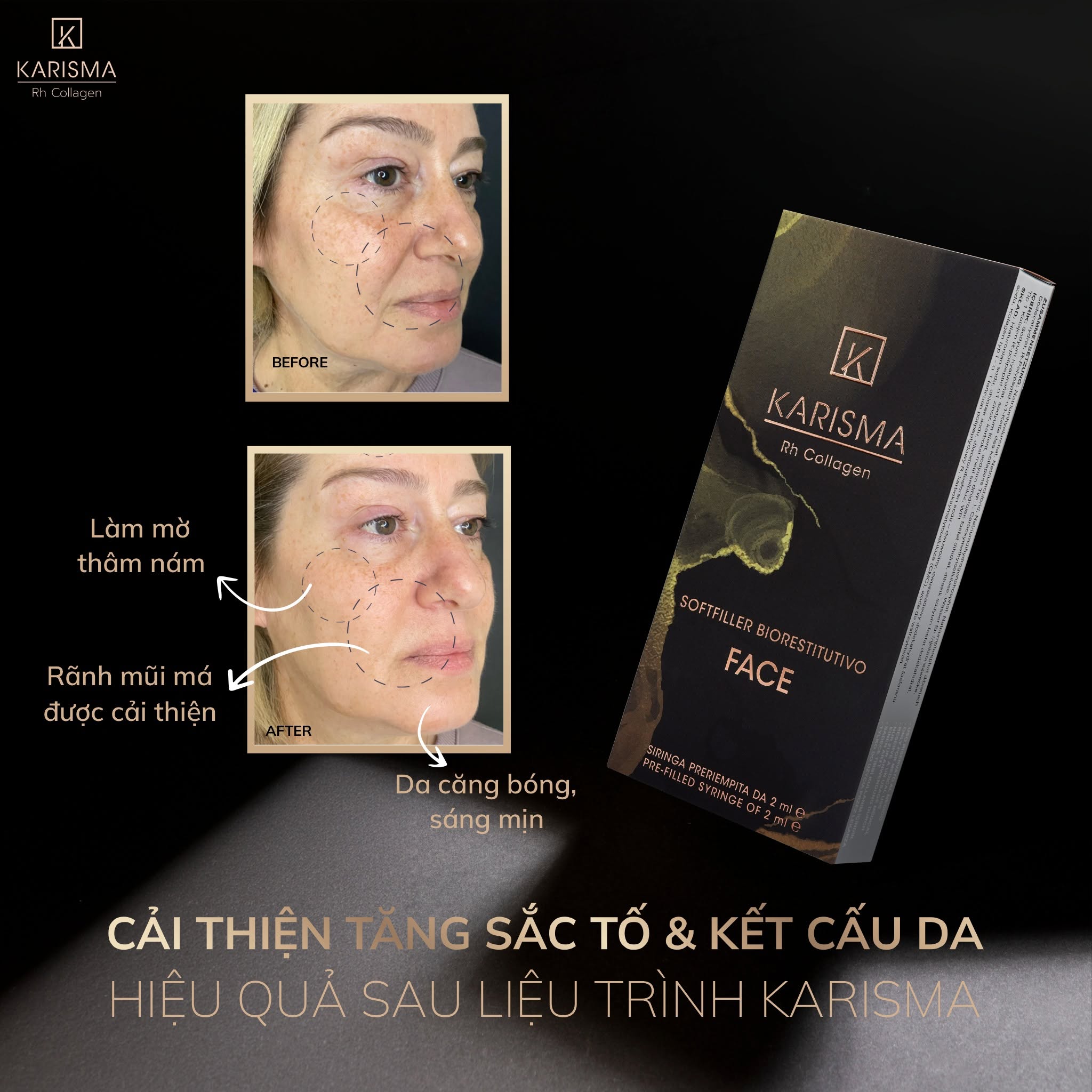 Karisma Rh Collagen Chính Hãng 6.jpg