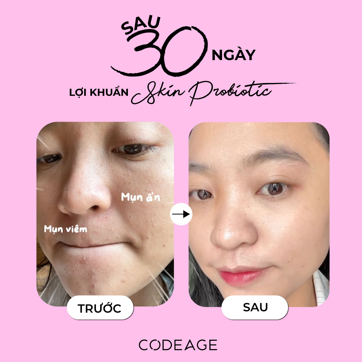 Vien-loi-khuan-can-bang-vi-sinh-lam-dep-da-Codeage-Skin-Probiotic-lo-60-vien_Viên lợi khuẩn cân bằng vi sinh làm đẹp da Codeage Skin Probiotic lọ 60 viên 6.jpg
