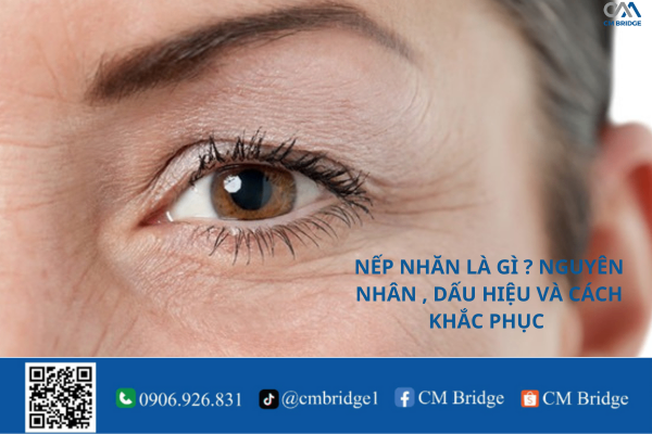 NẾP NHĂN LÀ GÌ ? NGUYÊN NHÂN , DẤU HIỆU VÀ CÁCH KHẮC PHỤC