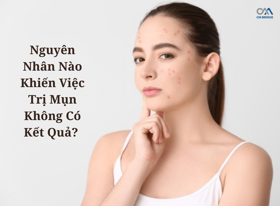 Nguyên Nhân Nào Khiến Việc Trị Mụn Không Có Kết Quả?