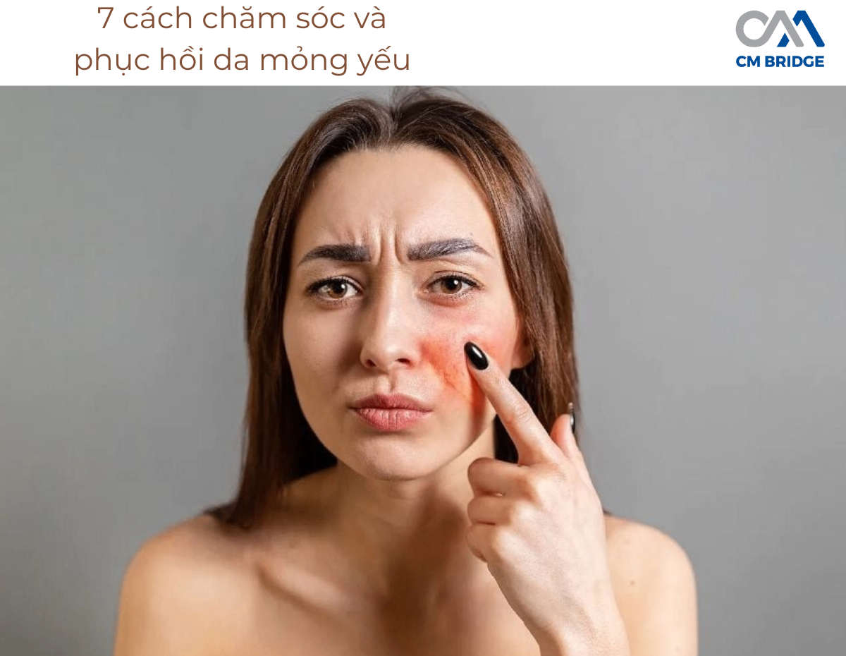 7 cách chăm sóc và phục hồi da mỏng yếu